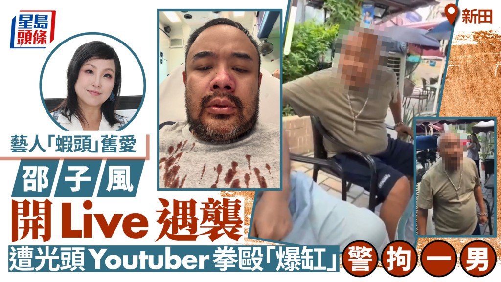「虾头旧爱」邵子风新田直播食饭 遭光头YouTuber拳殴致满面血 警拘一男涉袭击