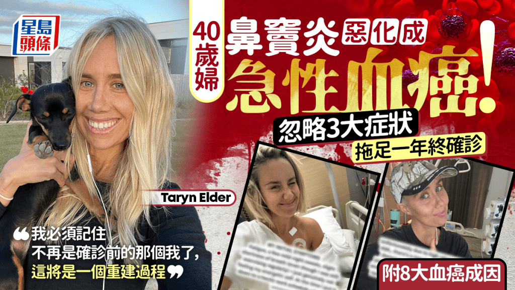40歲婦鼻竇炎惡化成急性血癌！忽略3大症狀拖足一年終確診 附8大血癌成因