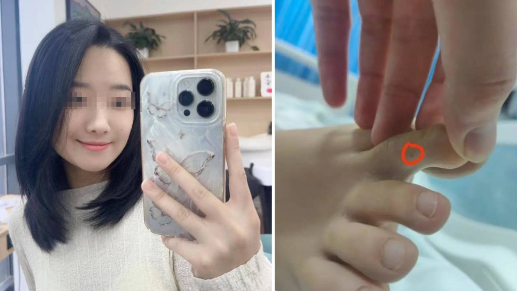 李甜甜日前腳部遭蛇咬，先後向兩間醫院求診但在2日不治。抖音