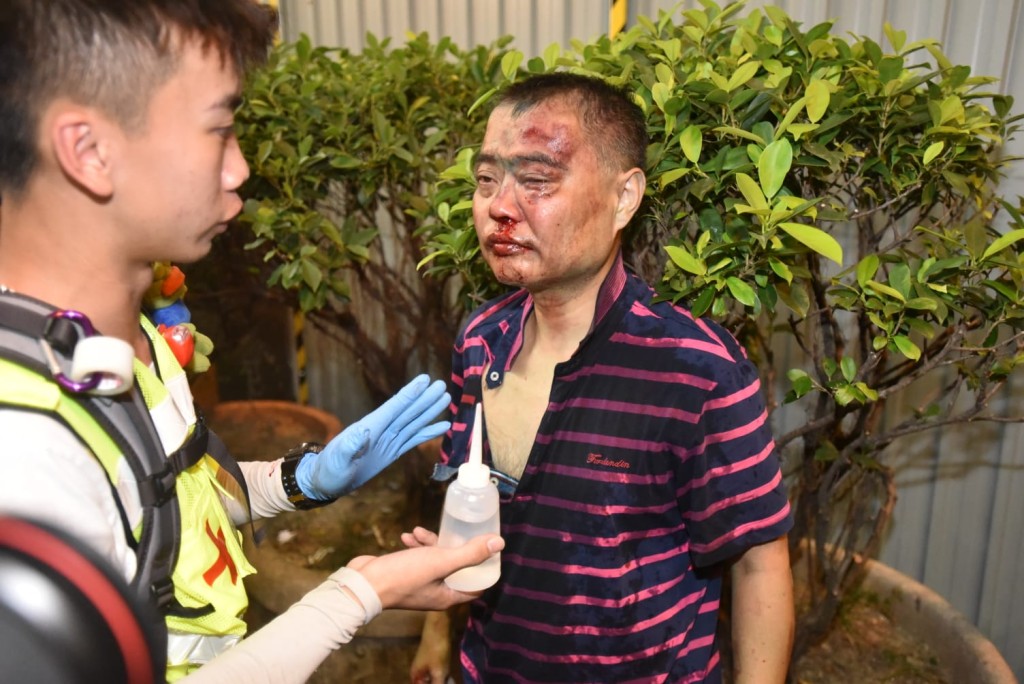 操普通話男子被圍毆。
