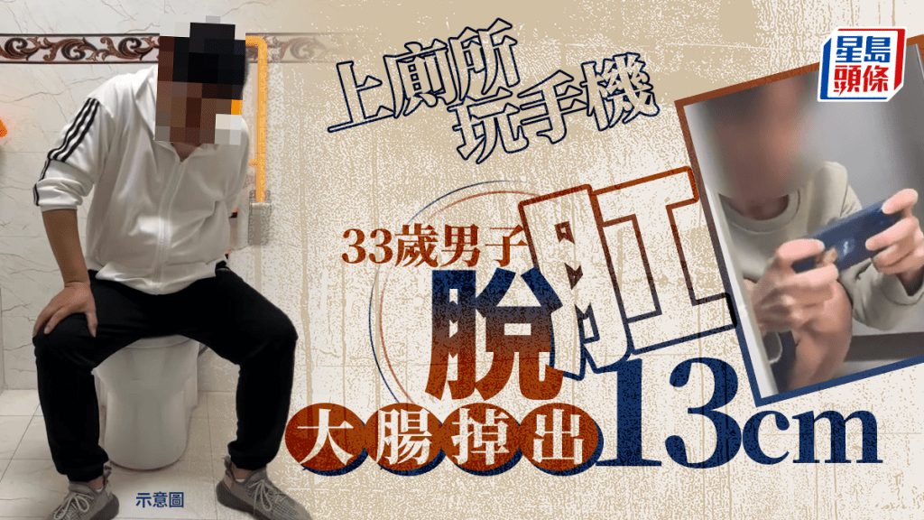上厠所玩手機蹲足2小時  33歲內地男腸子掉出13cm