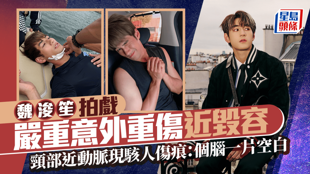 魏浚笙拍戲嚴重意外重傷近毀容 頸部近動脈現駭人傷痕：個腦一片空白
