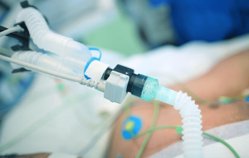 男子頭部重創送院後被宣告腦幹死亡，現時仍靠維生系統延命。Alamy示意圖