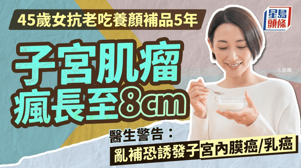 45歲女抗老吃養顏補品5年 子宮肌瘤瘋長至8cm 醫生警告：亂補恐誘發子宮內膜癌/乳癌
