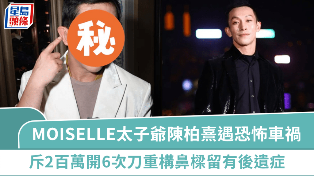 MOISELLE太子爺陳柏熹車禍後毀容  斥2百萬開6次刀重構鼻樑  口不能開太大留有後遺症