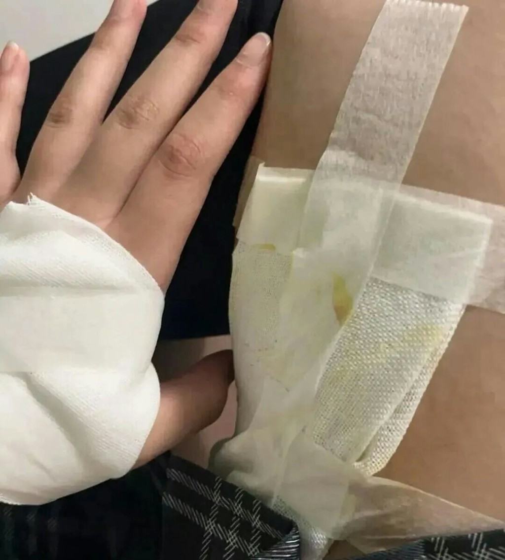 河南有开业仅2月商场爆天幕洒玻璃雨致多人浴血。红星新闻 河南有开业仅2月商场爆天幕洒玻璃雨致多人浴血。红星新闻