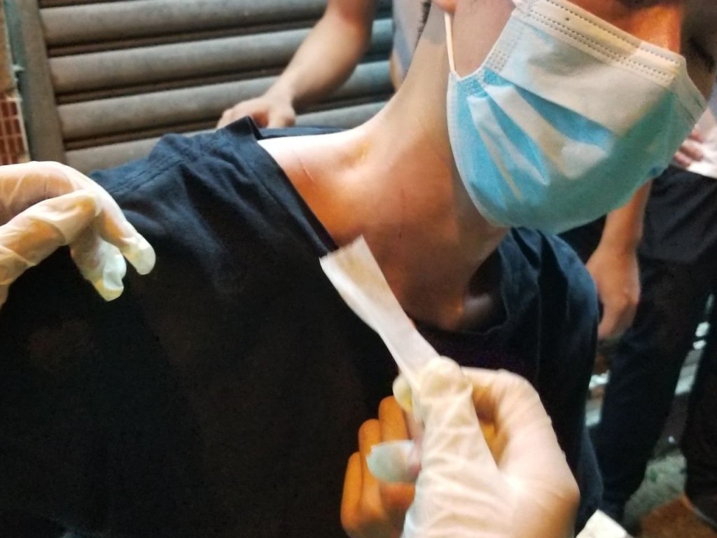 有示威者遇襲受傷。網上圖片