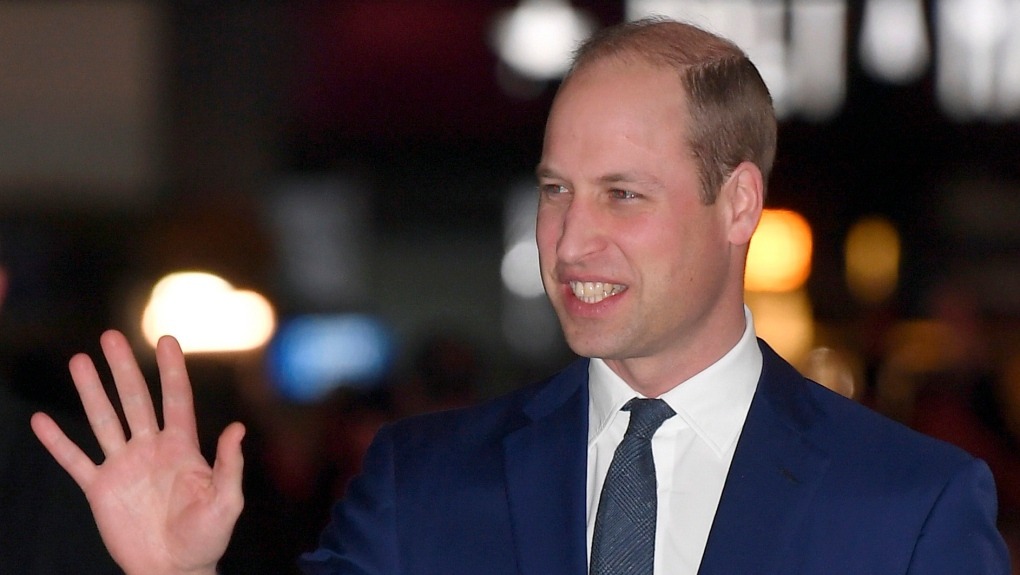 威廉王子早已被“秃头基因”困扰。美联社