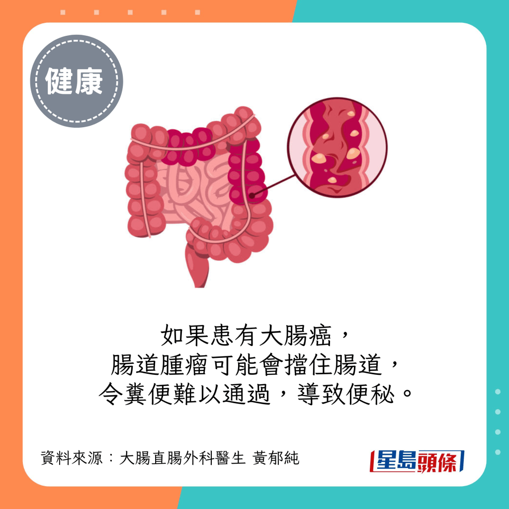 如果患有大腸癌，腸道腫瘤可能會擋住腸道，令糞便難以通過，導致便秘。
