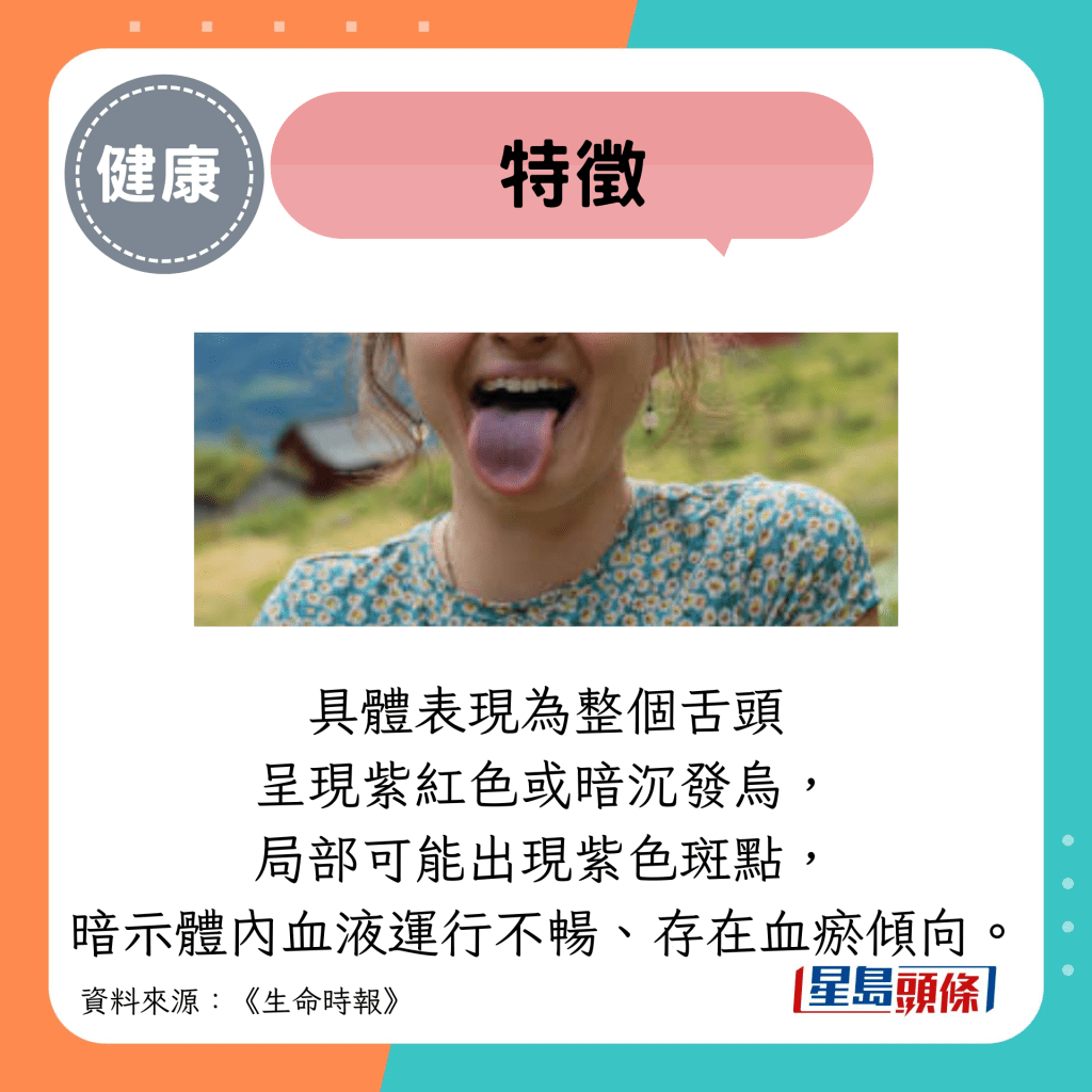 特征：具体表现为整个舌头 呈现紫红色或暗沉发乌， 局部可能出现紫色斑点， 暗示体内血液运行不畅、存在血瘀倾向。