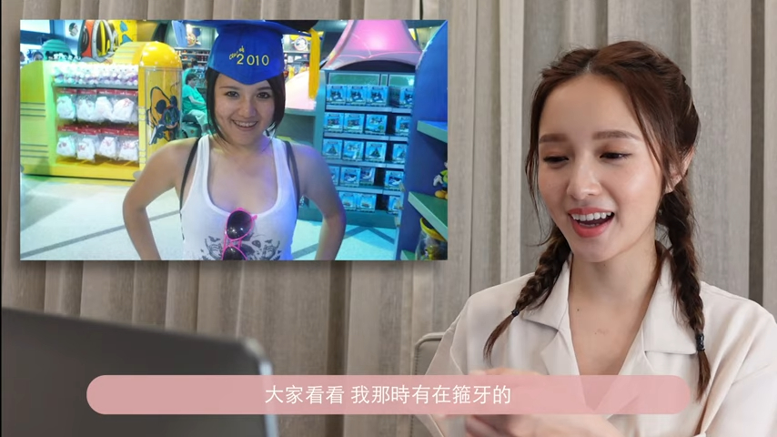 Judy以前有个猪胆鼻，现在却消失了！