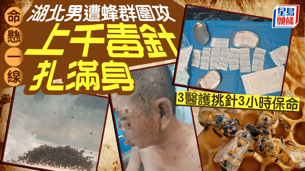 千支針刺在身｜湖北男遭蜂群圍攻險死 3醫護花3小時拔刺撿回一命