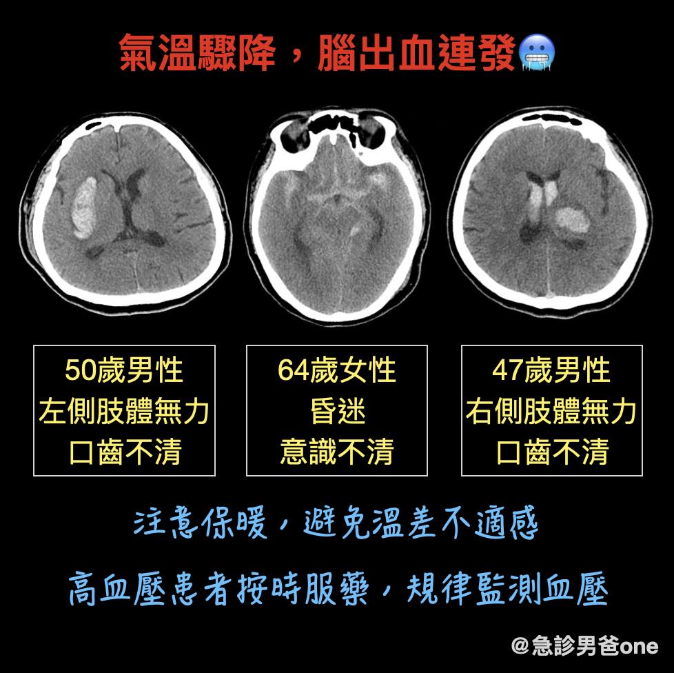 医生表示，曾1小时接收3名脑出血病人。（相片获「急诊男爸one」授权转载）