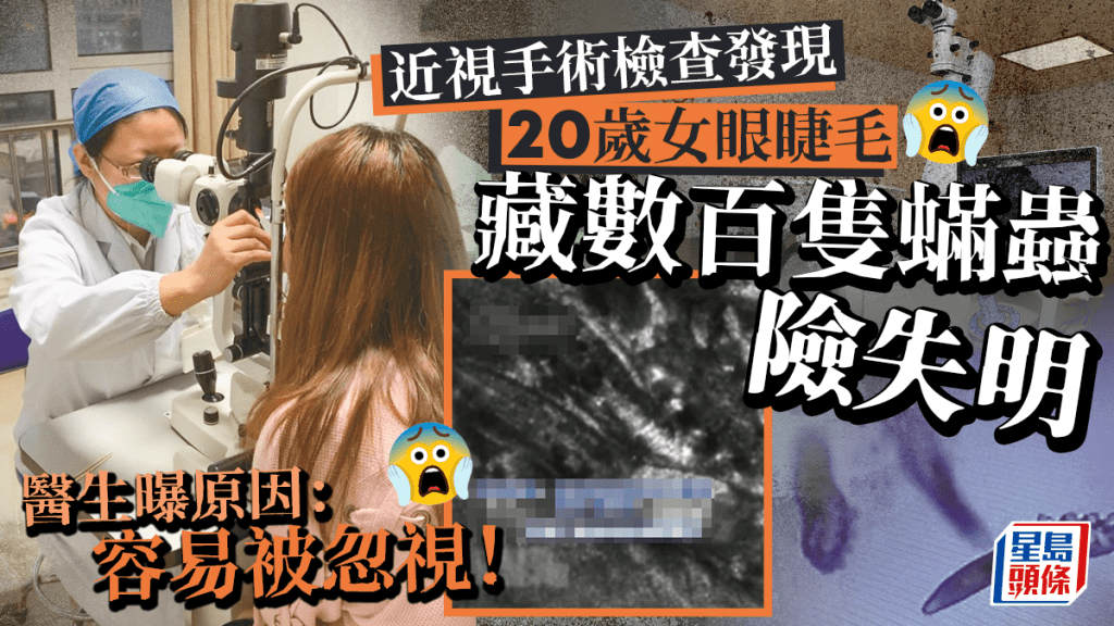 20歲武漢女眼睫毛驚現數百隻蟎蟲險失明 揭發原因係……