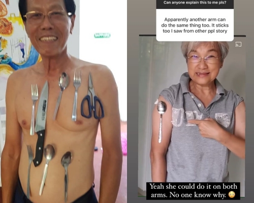 馬來西亞民眾打完疫苗後出現「金屬附體」 。網上圖片