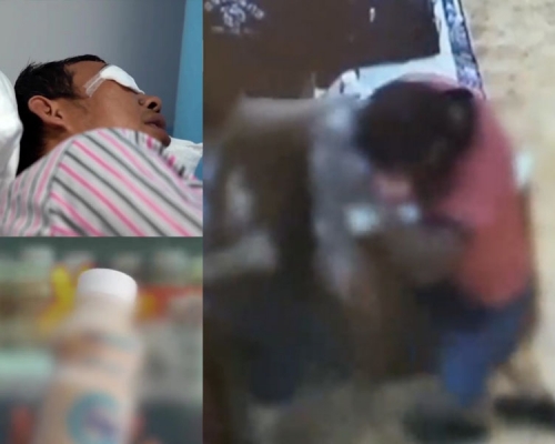 瓶裝酸奶突然自爆，一名送奶工不幸被炸傷右眼。（網圖）