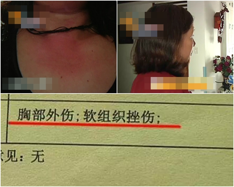 金女士指自己受傷。