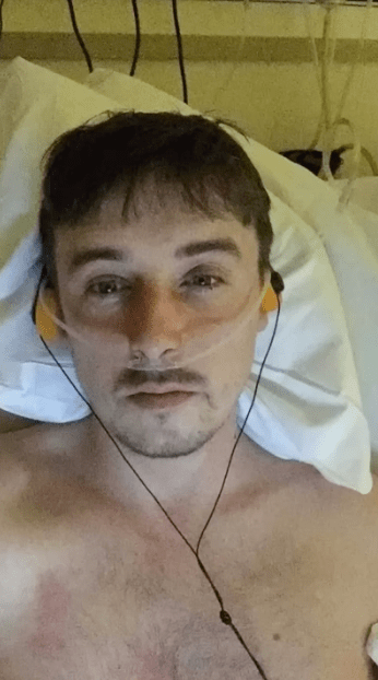 哈米尔在26岁时不幸患上罕见的阴茎癌。