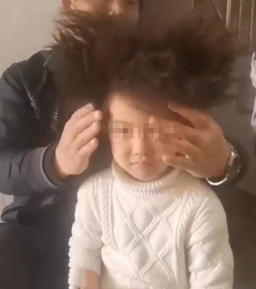 家長稱等孩子大一點再給她把頭髮拉直。