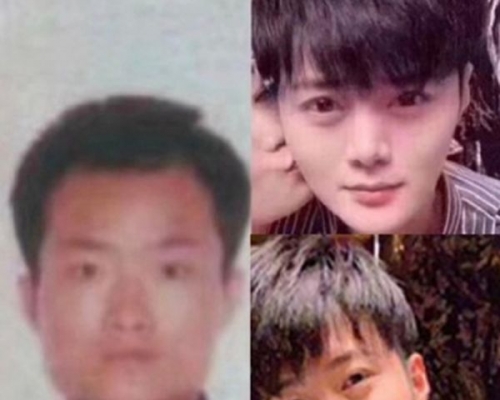 有網民Post出「鴨王」整容前的樣貎(左圖)，與現在的樣貎做對比。網圖