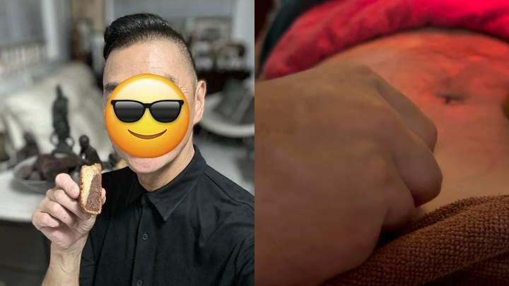 67歲時尚界猛人血腥治腳患再埋線減磅？   有家族癌症史兩度切除腫瘤阻止擴散
