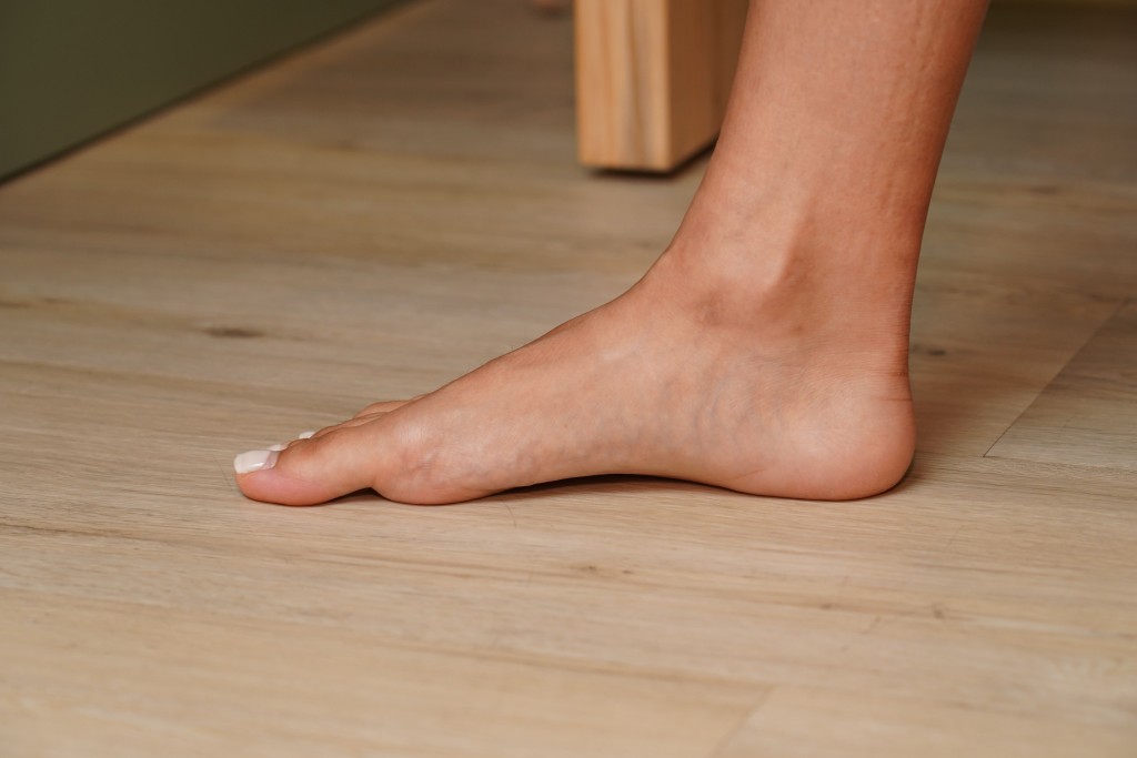扁平足泛指足弓的高度降低或消失，由於足部失去正常緩衝和避震功能，會帶來肌肉疲勞、腿部疼痛等問題。