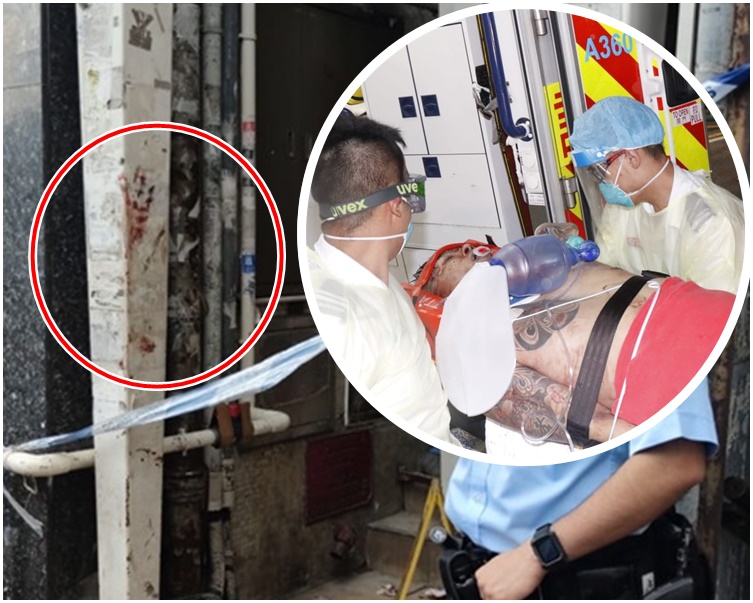 死者頭部重傷。現場地下樓梯遺下血掌印。