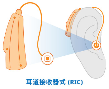 機身掛耳背、喇叭入耳的「耳道接收器式」(RIC) 機身掛耳背、喇叭入耳的「耳道接收器式」(RIC)