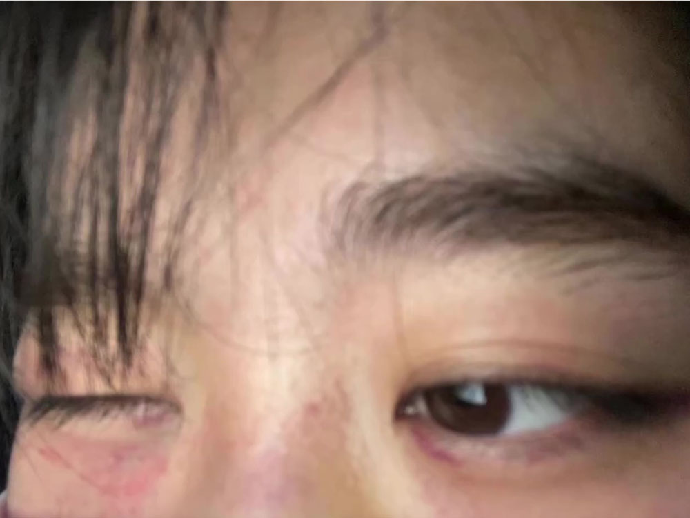 劉女子曾被前度男友家暴。