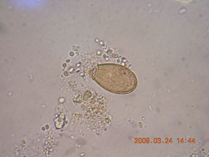 中華肝吸蟲蟲卵（示意圖，圖片來源：維基百科）