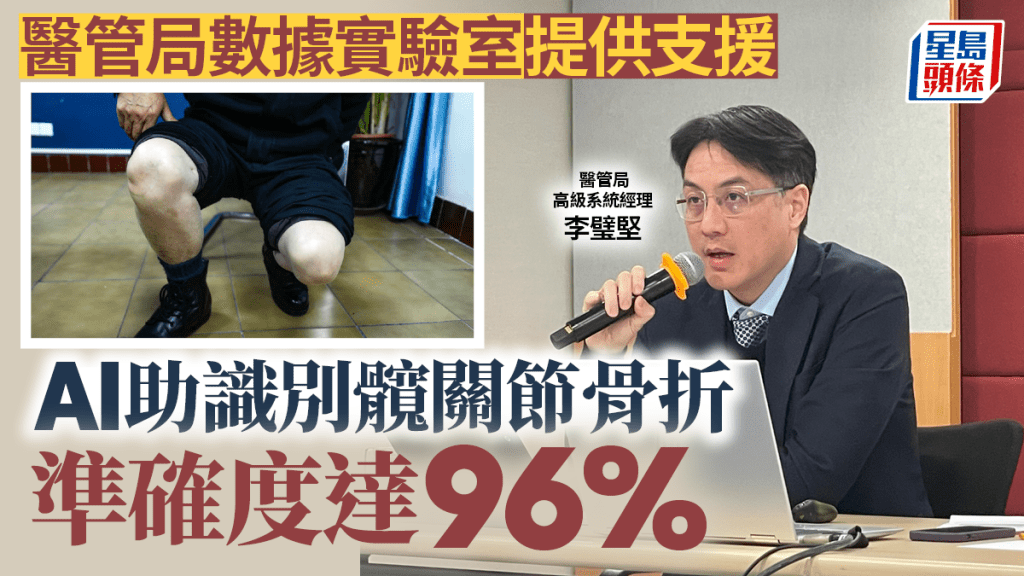 大數據︱醫管局數據實驗室提供支援 AI助識別髖關節骨折 準確度達96%