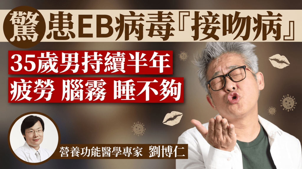 35歲男持續半年疲勞、腦霧、睡不夠  驚患EB病毒「接吻病」