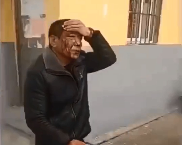 有人疑似血流披臉。影片截圖