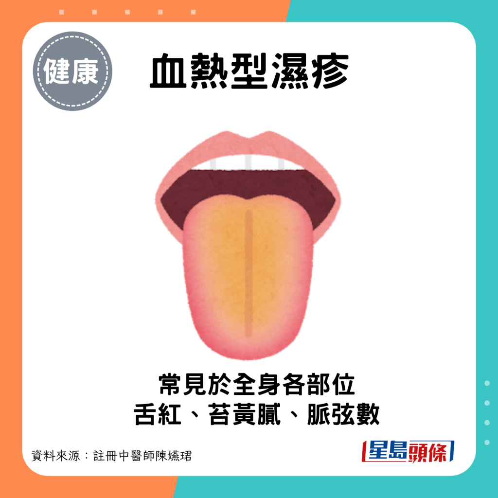 血熱型濕疹：舌紅，苔黃膩，脈弦數。