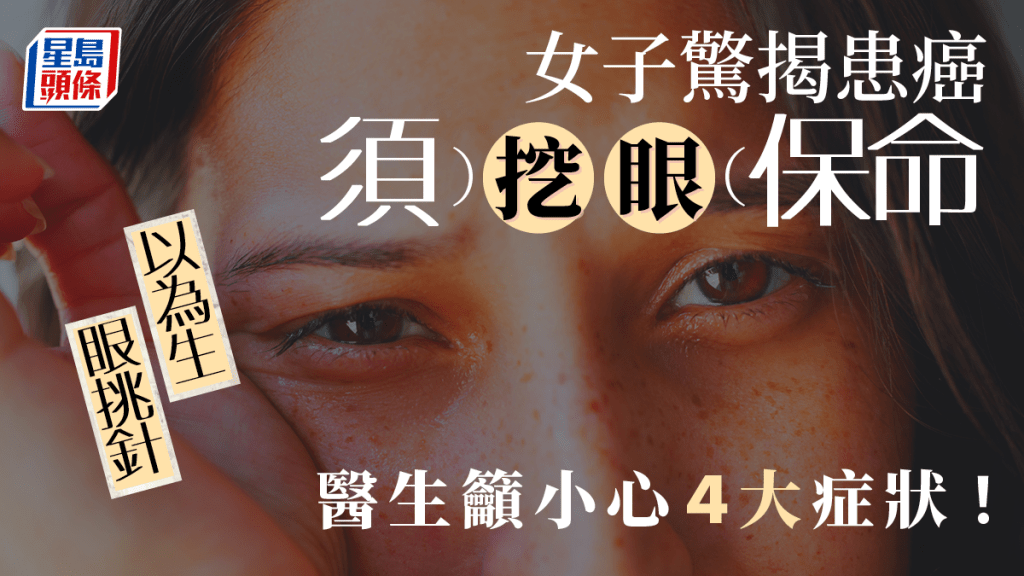 一名女子以為生眼挑針，求醫始知患癌，須挖眼保命。