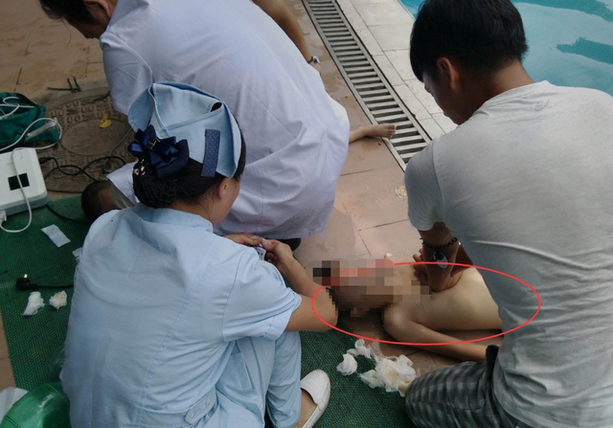眾人救起男童並做急救。 網圖