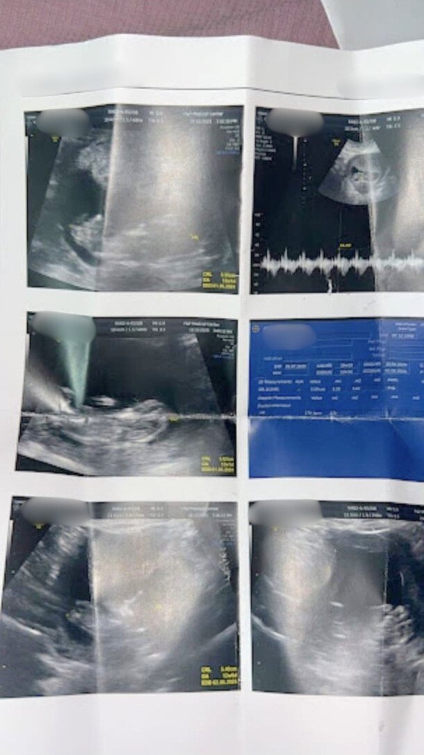 陳小姐稱懷孕期間再被鄭男虐打，險告流產，幸好最好保住胎兒誕下兒子。(被訪者提供圖片)