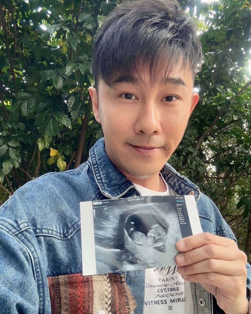 甄澤權年初宣布將會做爸爸。