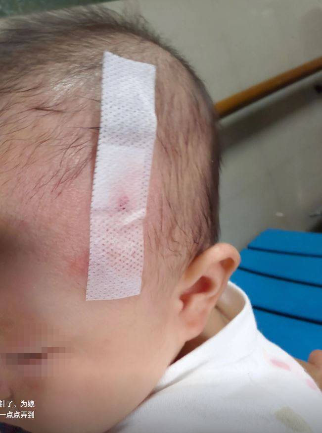 「洢諾」女兒被撞至滿頭傷。抖音
