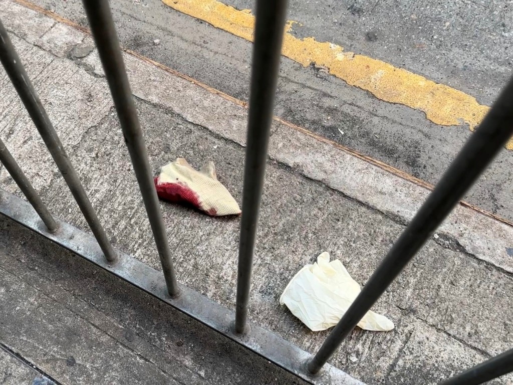 現場遺留染血紗布。