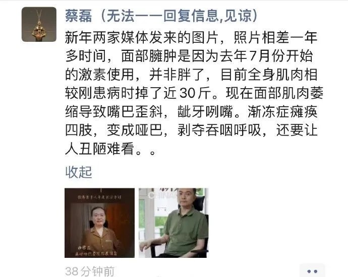 蔡磊在網上分享他的病況。蔡磊破冰驛站 蔡磊在網上分享他的病況。蔡磊破冰驛站