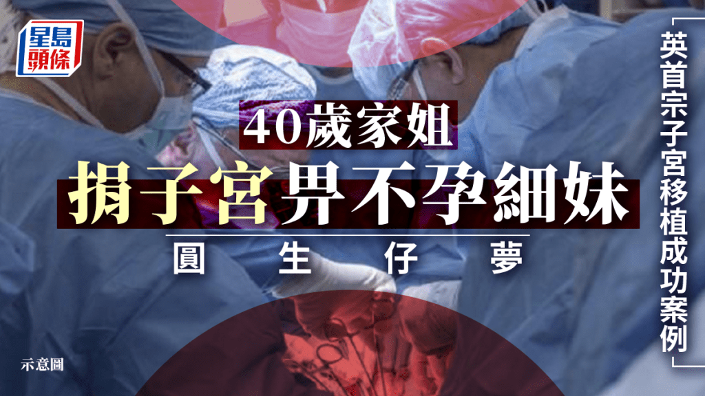 英首宗子宮活體移植成功 40歲姊捐子宮給不孕妹助圓生仔夢