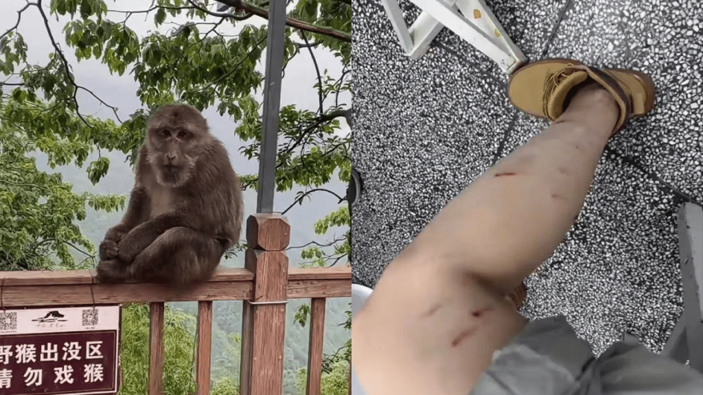遊客劉女士被猴群襲擊至腿上有多處傷痕`。（微博）