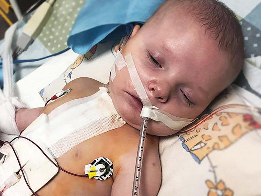 僅8個月大的Milos患有多重心臟及靜脈問題。網圖