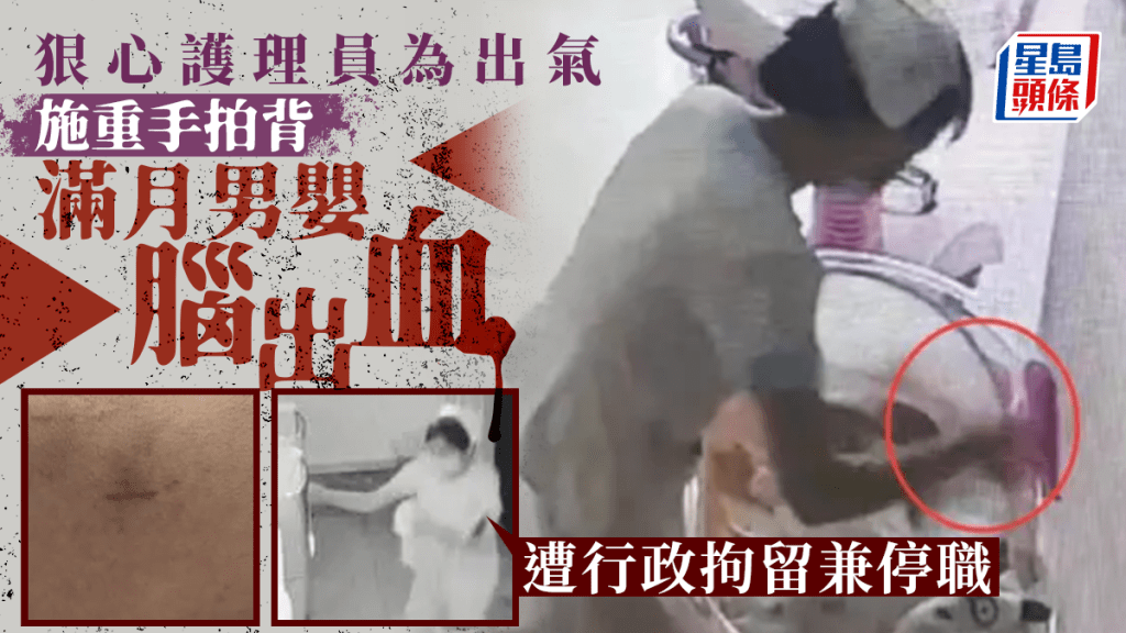 坐月中心的护工拿满月男婴拍打出气致脑出血。