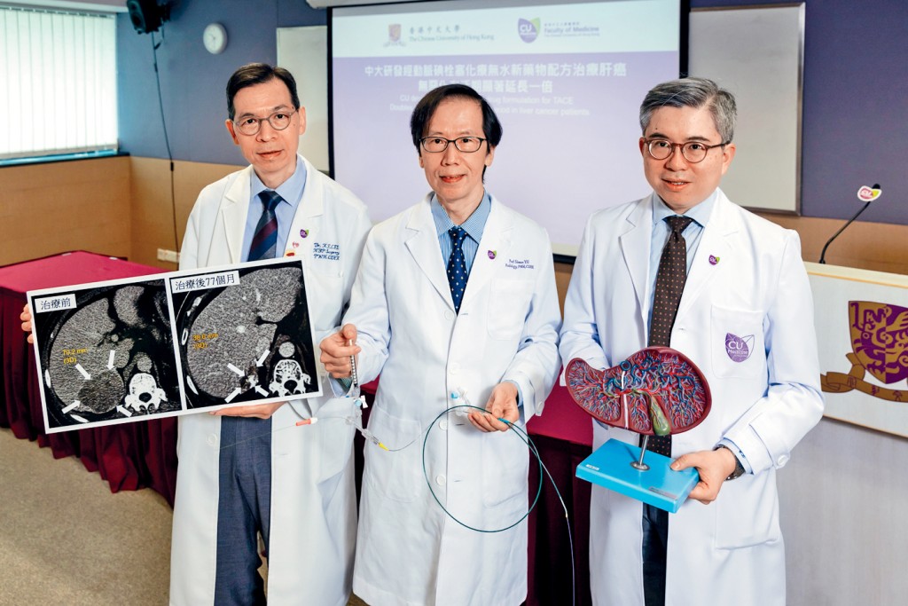 左起：中大醫學院外科學系肝膽胰外科名譽臨床副教授李傑輝、中大醫學院影像及介入放射學系名譽臨床教授余俊豪、中大醫學院腫瘤學系教授陳林。