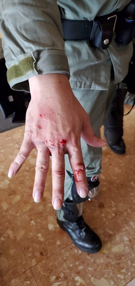 警方指有警員被腐蝕性液體濺中灼傷。警方圖片