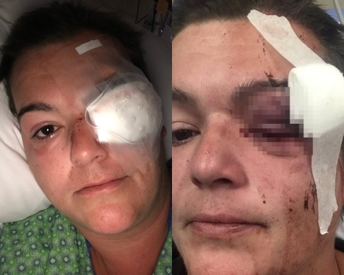 女自由攝影記者蒂拉多(Linda Tirado)來自納什維爾。網圖