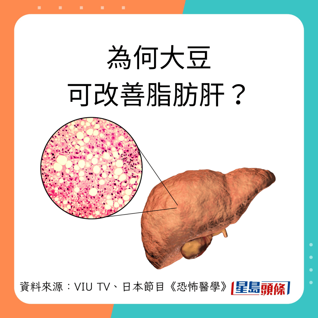 日本医生解构脂肪肝及大豆的关系。