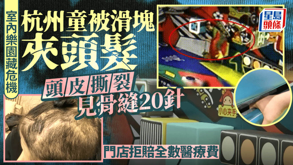 5歲童在遊樂園發生意外頭皮撕裂。